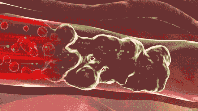 1605423880981698.gif